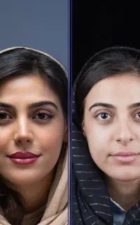 عمل بینی با امکان نظردهی حین عمل+اقساط