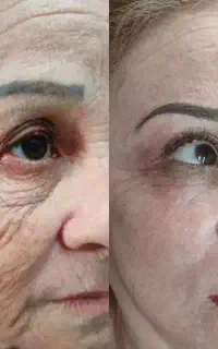 درمانگر ریزش مو و مراقبت های پوستی