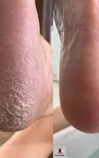 تخفیف ویژه پدیکور وناخن