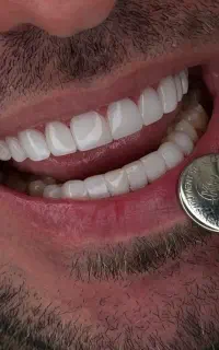 آموزش کامپوزیت