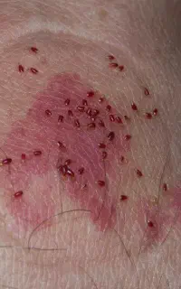 سمپاشی سم پاشی و موریانه زدایی تضمینی تخصصی