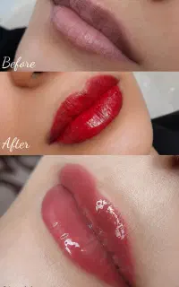 شیدینگ لب تخصصی در اصفهان رفع تیرگی لب+رنگ طبیعی