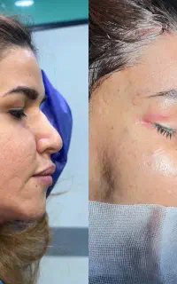 عمل بینی فقط ۴۴ دکتر متخصص اهواز