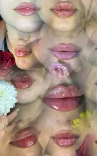 فیلربوتاکس1450