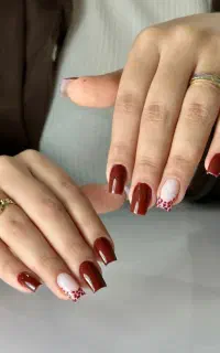 کاشت ناخن