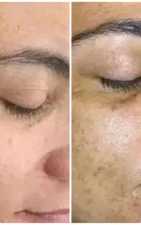 فیشیال تخصصی آف محدود فقط 150