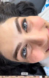 آف بوتاکس کامل صورت دیستون و مصپورت فقط ۷۵۰