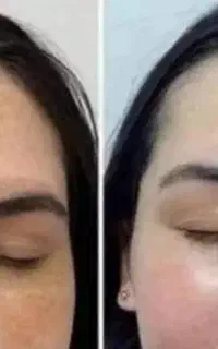 پاک کننده کک مگ
