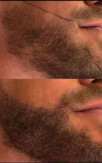 این اقدام اخریشه