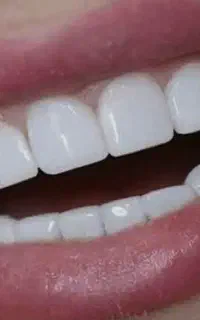 با ما لبخند زیبایی داشته باشید.