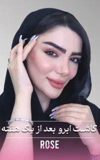 میکرو کاشت ابرو 20 میلیون تخفیف+پرداخت اقساطی