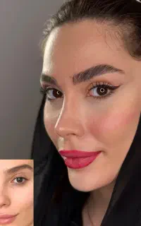 جراحی بینی فقط با ۲۹ میلیون‌تا‌خردادماه