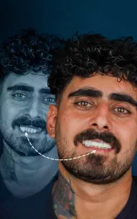 ایمپلــنت‌درجه‌یک‌کره//مرکزتخصصی‌کاشت‌دندان/اقساطی