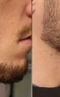 موهات خالی  شده علت داره