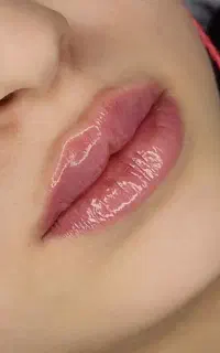 زیبایی بدون تغییر چهره کاملا نچرال در کلینیک الا