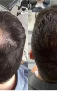 پر پشت شدن موها تون رو با ما تضمین کنید