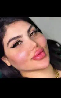 تزریق چربی به صورت بیکینی باسن هیپ دیپ وساکشن غبغب