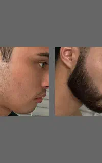 چرا بعضی ها ریش دارن تو نداری جواب اینجاست