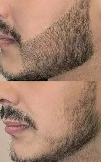 بدون درد کارو جمع کن