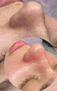 آموزش صفر تا صد پوست