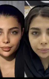با پول یک پاکسازی، هایفو بزن فقط 890 ت