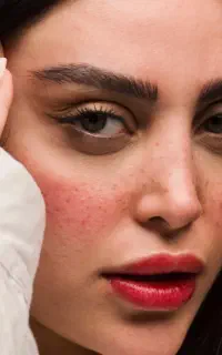 میکروبلیدینگ ابرو خداحافظی با مداد ابرو