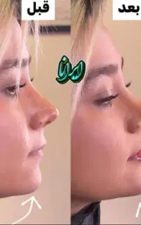«دکتر کامبیز محمدپور»پکیج تالیامعجزه تزریق فیلر ژل
