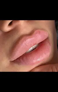 جشنواره لیزر موهای زائد