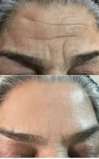 کرم فوری ضد چین وچروک اصل