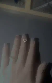 کاشت.ترمیم.لمینت.ژلیش