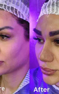 کاشت ابرو با تراکم بالا و قیمت منصفانه