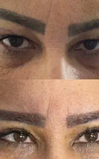 تخفیف ویژه جراحی های زیبایی ( جراحی بینی۳۵)