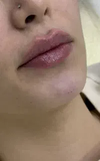 تخفیف ویژه خدمات زیبایی