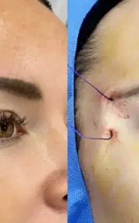 خدمات فیلر بوتاکس پی ارپی لیفت نخ فیلر بادی