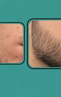 ریشوی قدرتمند