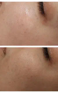 *فشیال و هایفوتراپی*جشنواره عید تا عید*