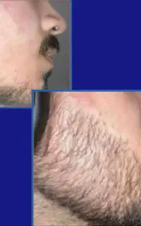 پر پشتی و حجم دهی ریش و سبیل‌تون با ما