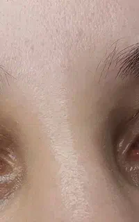کاشت واکستنشن مژه کراتین پروتئین مولیفت ناخن بافت