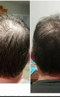 موهاتو کاشت نکن عزیزم