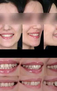 ارتودنسی توسط متخصص اقساطی بدون چک مشاوره رایگان