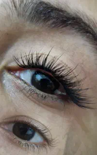کاشت مژه