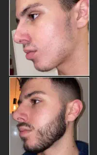 محصول تقویت ریش و سبیل