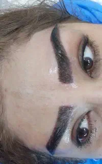 تخفیف فوق العاده کاشت ابرو
