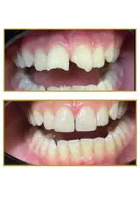 خدمات کامل دندانپزشکی