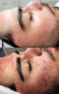 فیشال وپاکسازی آقایان کلینیک پزشک پنجشنبه ۶۹۰