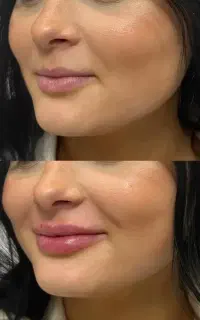 کلینیک تخصصی اریکا (لیزر و پوست و‌ مو )