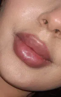 کلینیک تخصصی زیبایی بارمان ،لیزر موهای زائد