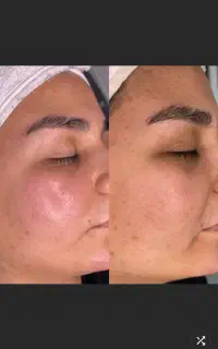 فیشال تخصصیودرمانی ۳۰تا۴۰٪تخفیف واقعی فقط تادوشنبه