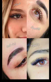 کاشت مژه
