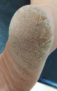 پاهای لطیف پدیکور کفسابی